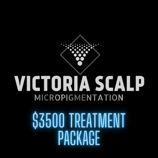 $3500 SMP TREATMENT PACKAGE